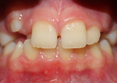Ortodoncia_51-400x284-1