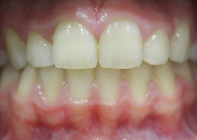 Ortodoncia_53-400x284-4