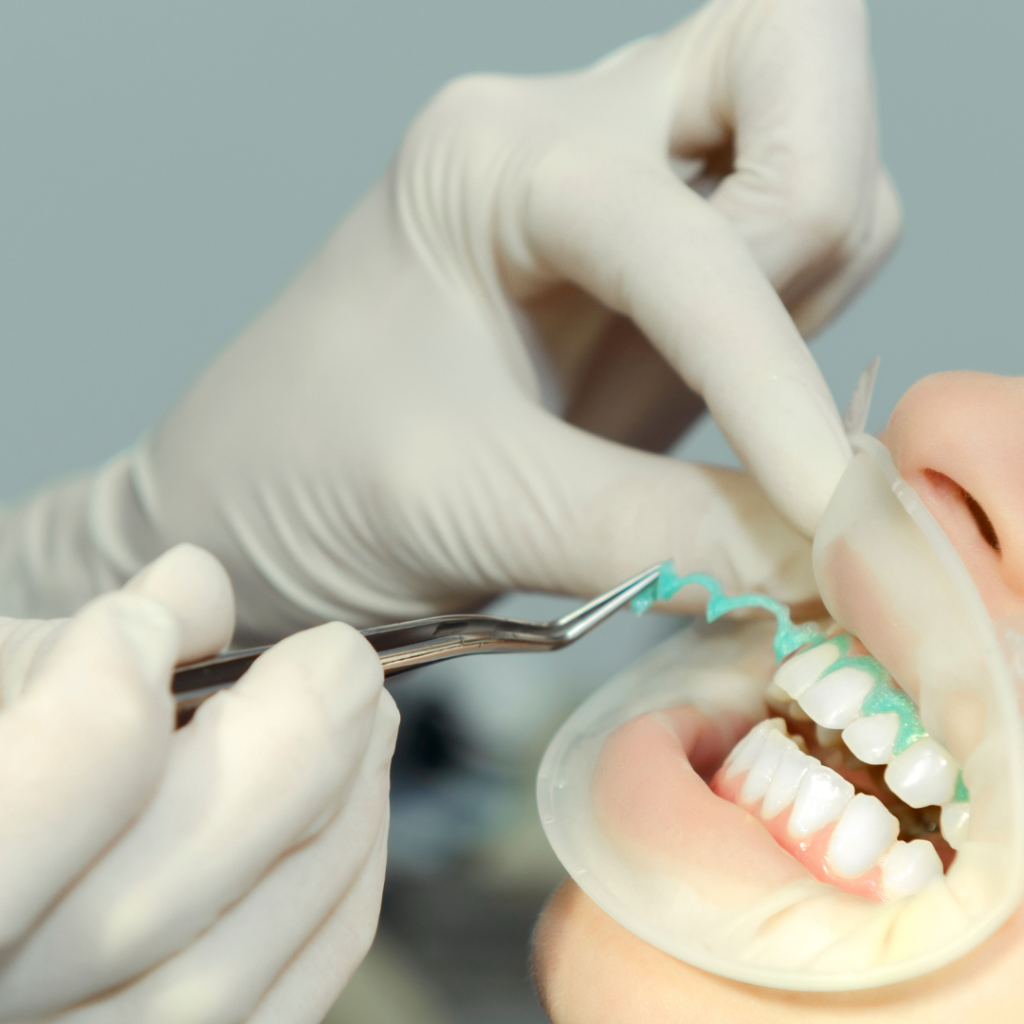 Blanqueador Dental: El Secreto para una Sonrisa Deslumbrante